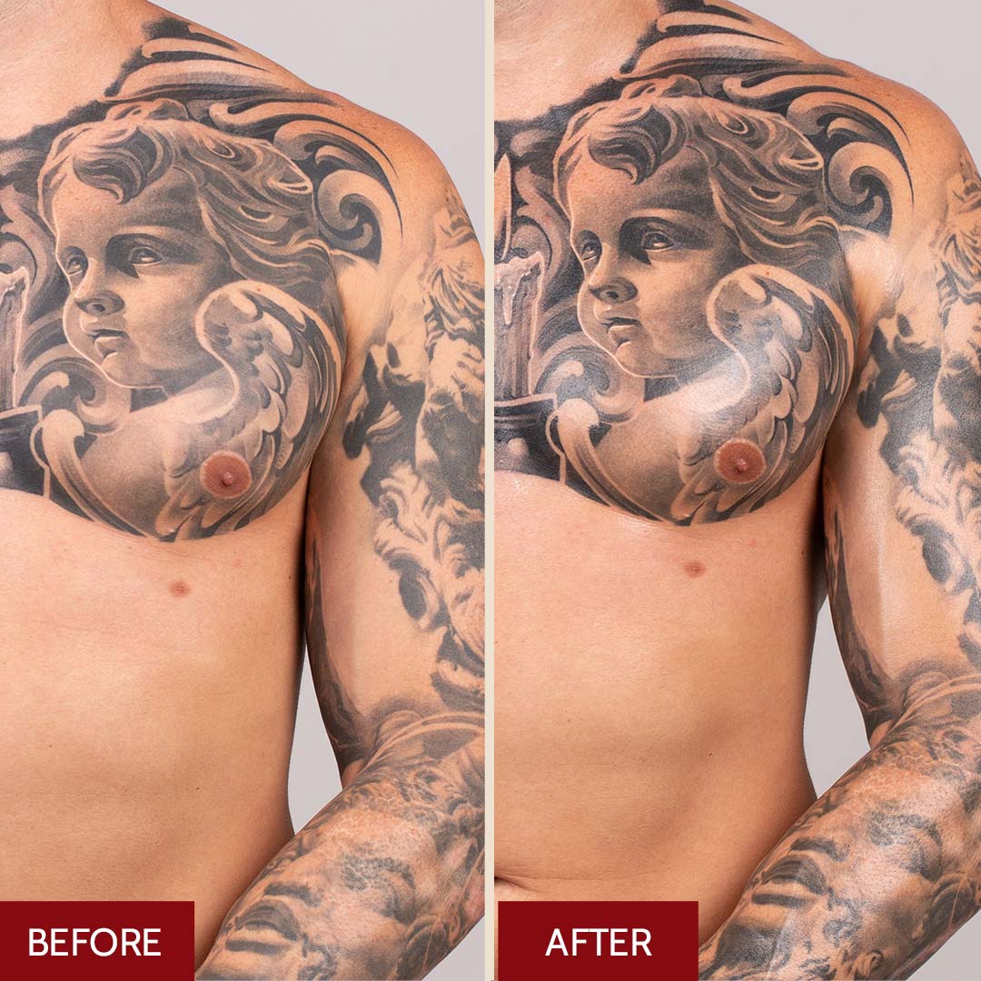 Buy Tattoo Brightener Online In India  Etsy India